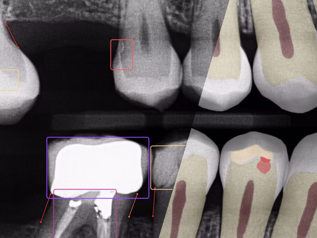 Adravision for Clinics