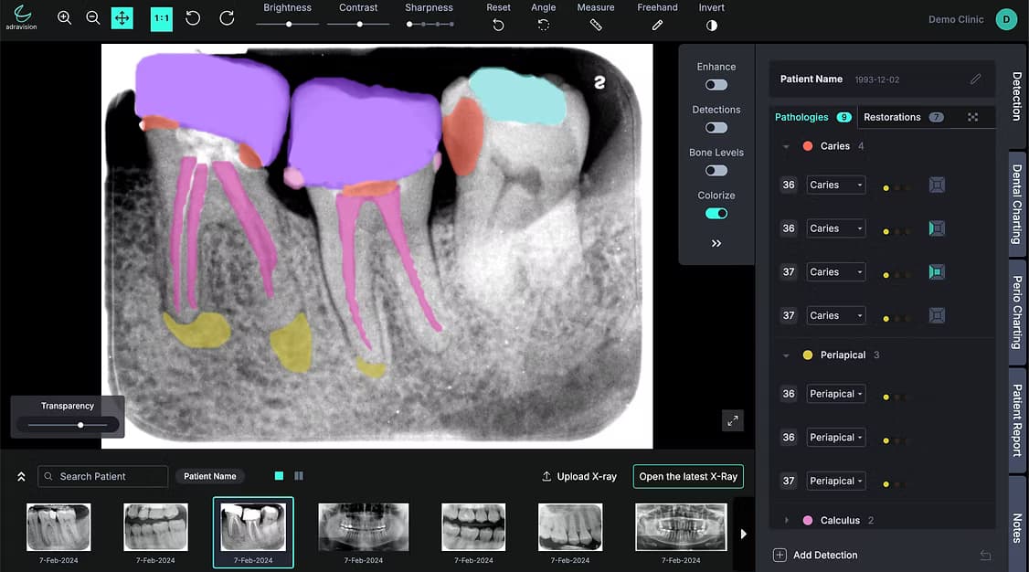 Adravision dental automation platform