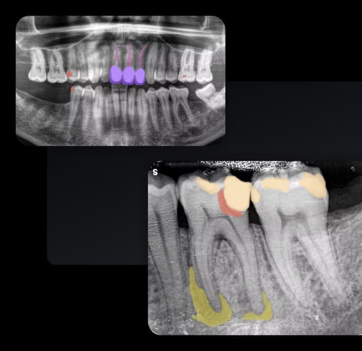 Enhance patient communication with clear visualizations