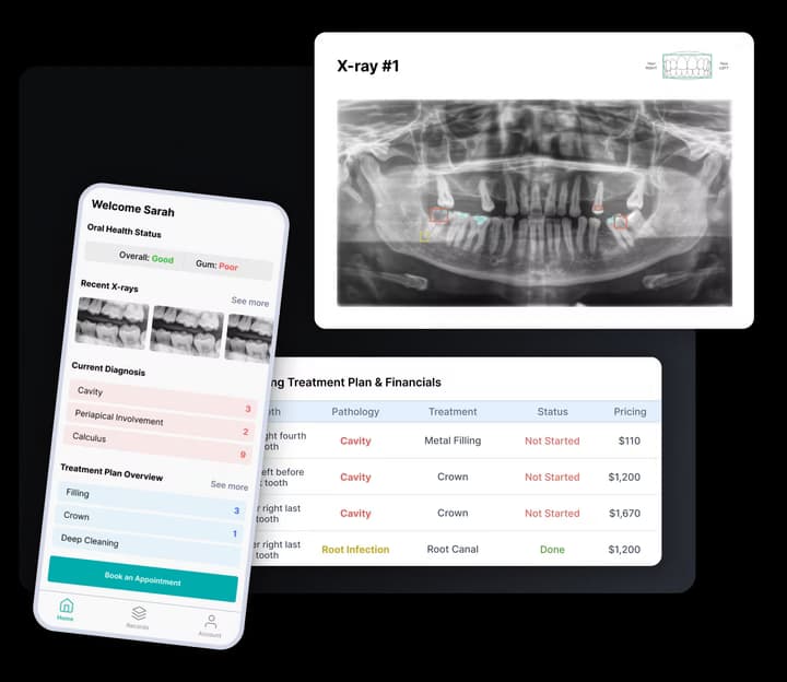 Feature visualization